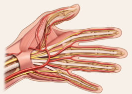 Hand, Wrist, and Finger Injury Case Value Compensation Payout