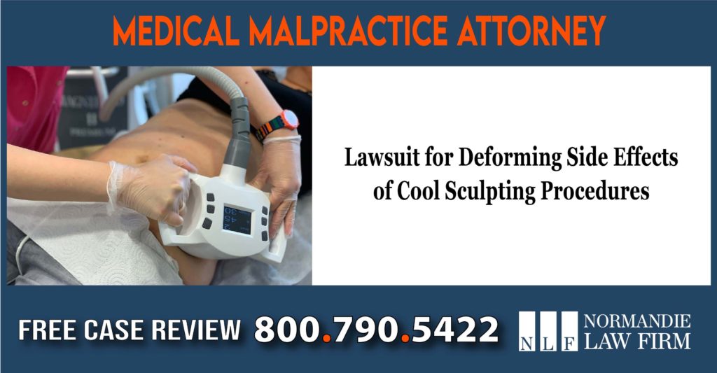 Lawsuit for Deforming Side Effects of Cool Sculpting Procedures lawyer sue lawsuit compensation incident