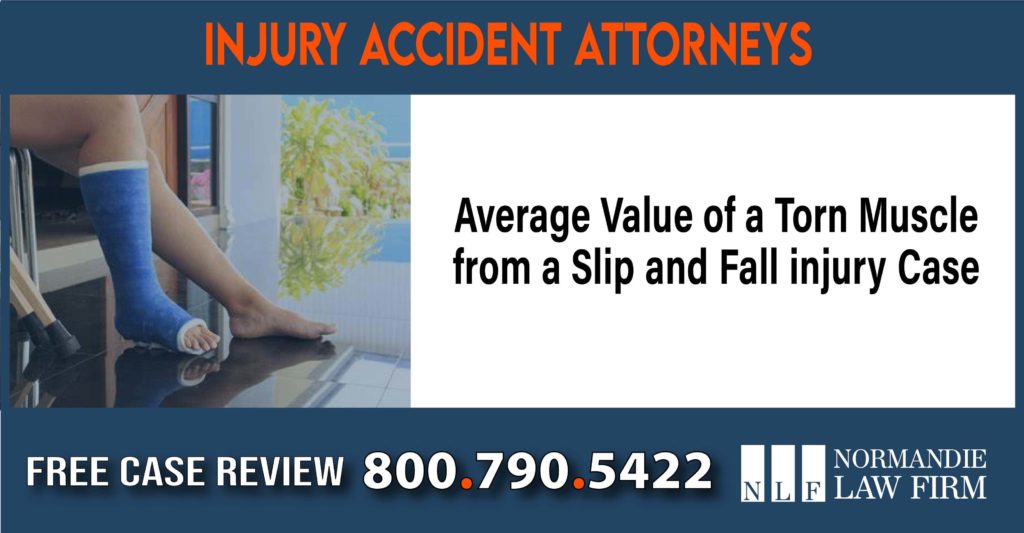 Average Value of a Torn Muscle from a Slip and Fall injury Case sue liability lawyer compensation incident