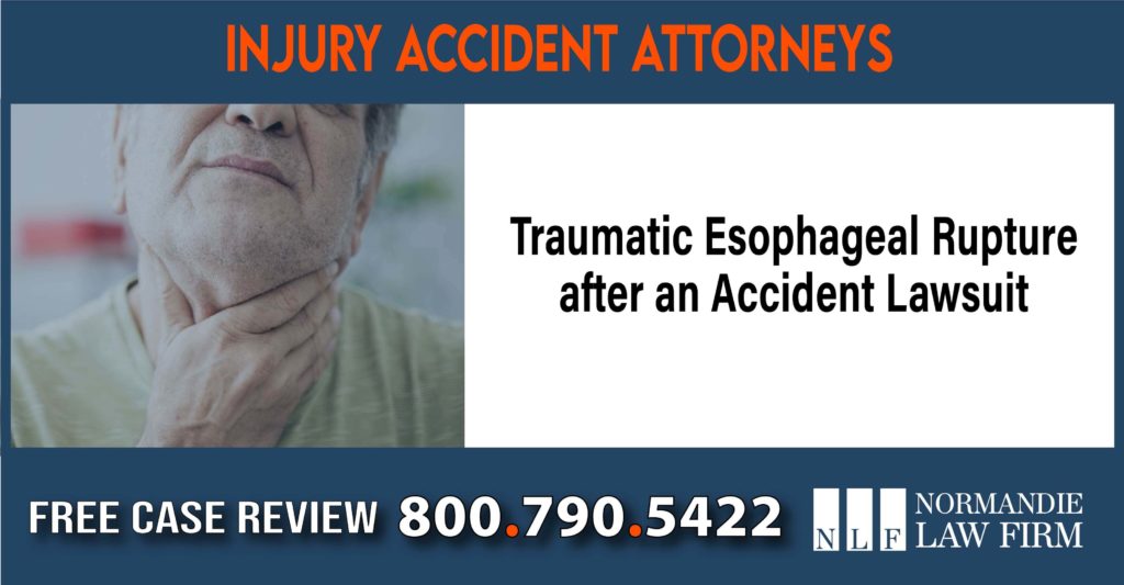 Traumatic Esophageal Rupture after an Accident Lawsuit Attorney sue liability lawyer compensation incident