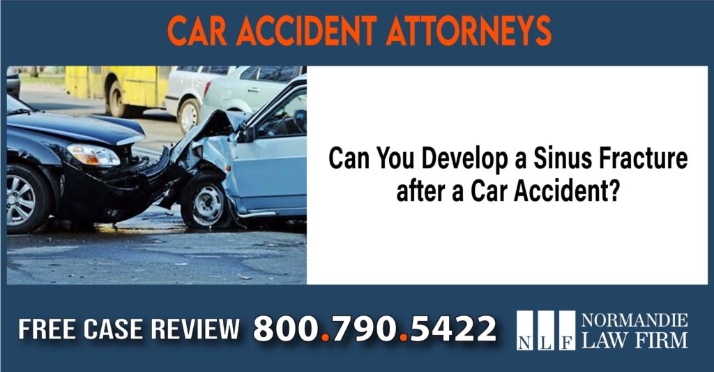 Can You Develop a Sinus Fracture after a Car Accident sue liability lawyer attorney compensation incident