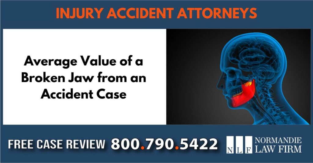 Average Value of a Broken Jaw from an Accident Case sue attorney lawyer compensation