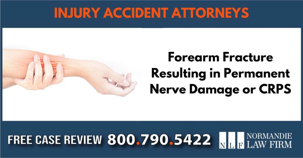 Forearm Fracture Resulting in Permanent Nerve Damage or CRPS sue liability lawyer attorney