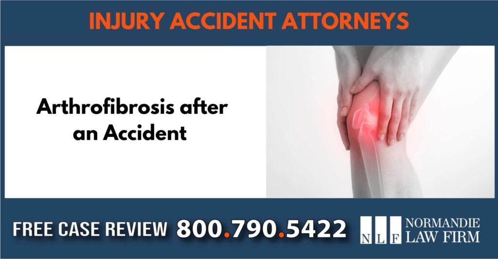 Arthrofibrosis after an accident incident compensation lawyer attorney